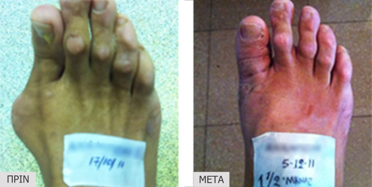 patient2_before-after