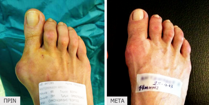 patient3_before-after_gallery