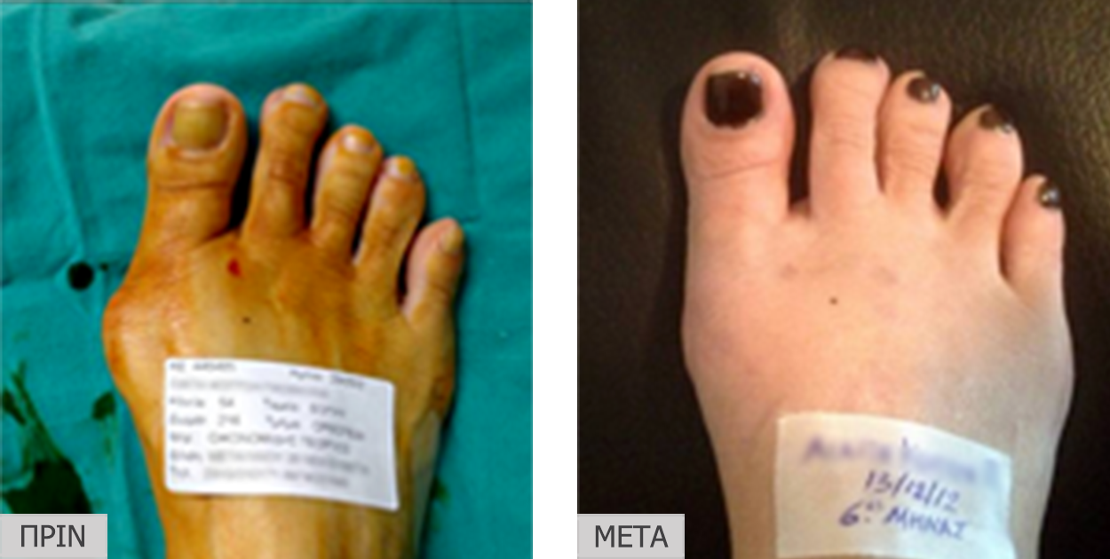 patient6_before-after
