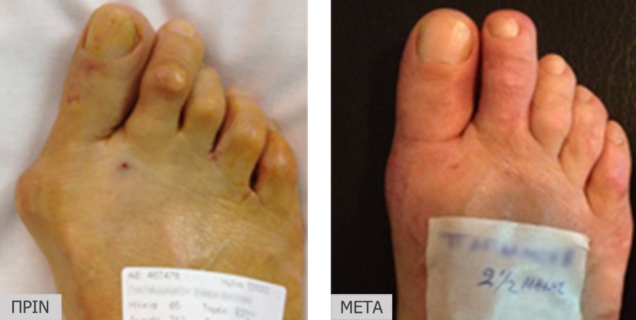 patient7_before-after