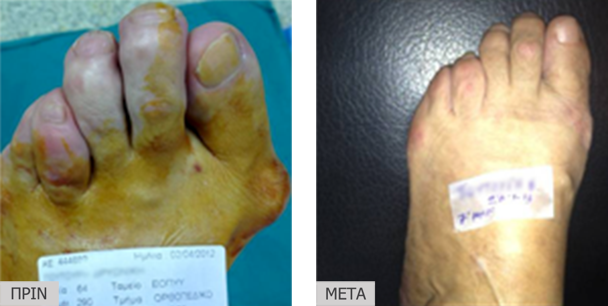 patient8_before-after